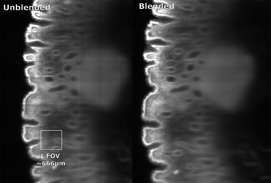 Large intestine imaged using Luxendo MuVi SPIM Light-Sheet Microscope