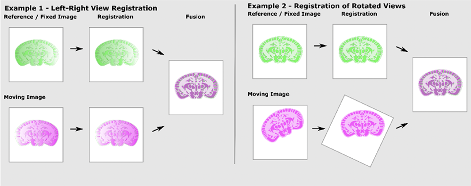 Registration and fusion process of moving images to a fixed image. Example 1: Left-right fusion between opposing views. Example 2: Registration of images from different views into one spatial coordinate system.