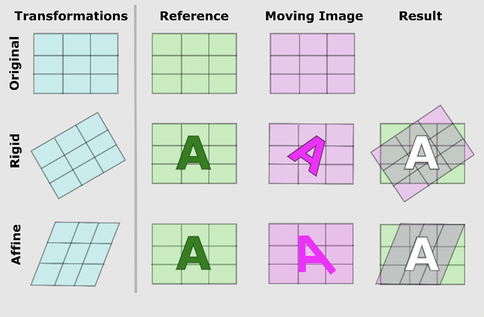  Comparison of registration approaches for moving images to a fixed image.